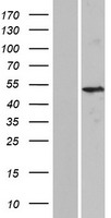 ls008688 krt37 human over expression lysates nm 003770 wb testing 1