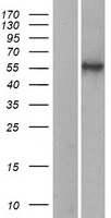 ls008692 hyal2 human over expression lysates nm 033158 wb testing 2