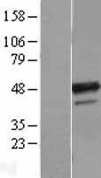 B4GALT3 Human Over-expression Lysates NM_003779