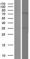 TNK1 Human Over-expression Lysates NM_003985