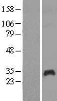 PAGE1 Human Over-expression Lysates NM_003785