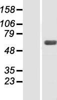 SNX4 Human Over-expression Lysates NM_003794