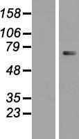 CTNNAL1 Human Over-expression Lysates NM_003798