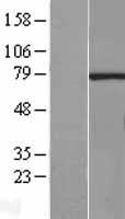 HCE (RNGTT) Human Over-expression Lysates NM_003800