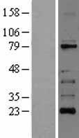 RIP (RIPK1) Human Over-expression Lysates NM_003804