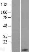 HRK Human Over-expression Lysates NM_003806