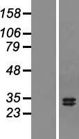 APRIL (TNFSF13) Human Over-expression Lysates NM_172088
