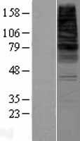 ls008760 cds2 human over expression lysates nm 003818 wb testing 1