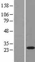 RAB11A Human Over-expression Lysates NM_004663