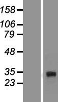 DcR3 (TNFRSF6B) Human Over-expression Lysates NM_003823