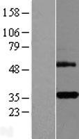 DcR3 (TNFRSF6B) Human Over-expression Lysates NM_032945