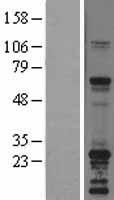 SNAP23 Human Over-expression Lysates NM_003825