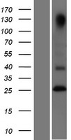 TNFRSF18 Human Over-expression Lysates NM_148901