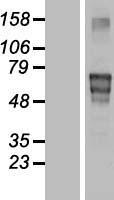 Matrilin 4 (MATN4) Human Over-expression Lysates NM_003833