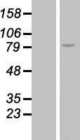 RGS9 Human Over-expression Lysates NM_001081955