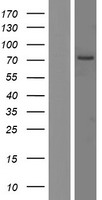 RGS9 Human Over-expression Lysates NM_003835