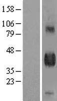 DLK (DLK1) Human Over-expression Lysates NM_003836