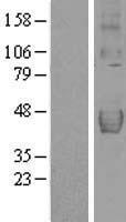 DcR2 (TNFRSF10D) Human Over-expression Lysates NM_003840
