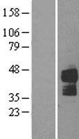 DR5 (TNFRSF10B) Human Over-expression Lysates NM_003842