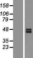 DR5 (TNFRSF10B) Human Over-expression Lysates NM_147187