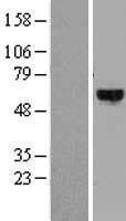 DYRK4 Human Over-expression Lysates NM_003845