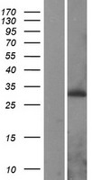 PEX11A Human Over-expression Lysates NM_003847