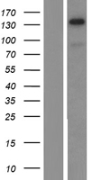 TIF1 alpha (TRIM24) Human Over-expression Lysates NM_015905