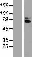 IL18R Beta (IL18RAP) Human Over-expression Lysates NM_003853