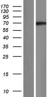 CCNK Human Over-expression Lysates NM_001099402