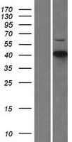 CDKL1 Human Over-expression Lysates NM_004196