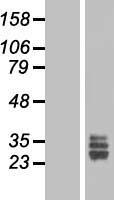 FGF18 Human Over-expression Lysates NM_003862