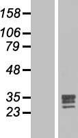 FGF17 Human Over-expression Lysates NM_003867