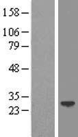 LIN7 (LIN7A) Human Over-expression Lysates NM_004664