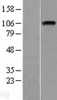 Neuropilin 1 (NRP1) Human Over-expression Lysates NM_003873