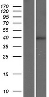 ls008832 cd84 human over expression lysates nm 001184881 wb testing 2