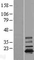 TMEM11 Human Over-expression Lysates NM_003876