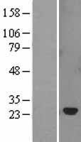 SOCS2 Human Over-expression Lysates NM_003877