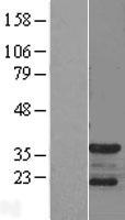 p35 (CDK5R1) Human Over-expression Lysates NM_003885