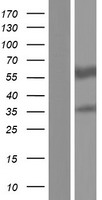 ls008854 aldh1a2 human over expression lysates nm 003888 wb testing 1