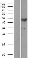 Protein Z (PROZ) Human Over-expression Lysates NM_003891