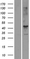 STK19 Human Over-expression Lysates NM_032454