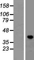 ls008861 ldb1 human over expression lysates nm 003893 wb testing 1