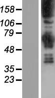 Synaptojanin (SYNJ1) Human Over-expression Lysates NM_001160302
