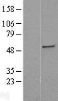 ST3GAL5 Human Over-expression Lysates NM_003896