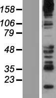 Synaptojanin 2 (SYNJ2) Human Over-expression Lysates NM_003898
