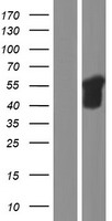 SQSTM1 Human Over-expression Lysates NM_001142298