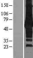 SQSTM1 Human Over-expression Lysates NM_003900