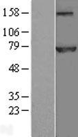 Apc6 (CDC16) Human Over-expression Lysates NM_003903