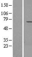 APPBP1 (NAE1) Human Over-expression Lysates NM_001018160