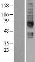 SLC5A6 Human Over-expression Lysates NM_021095